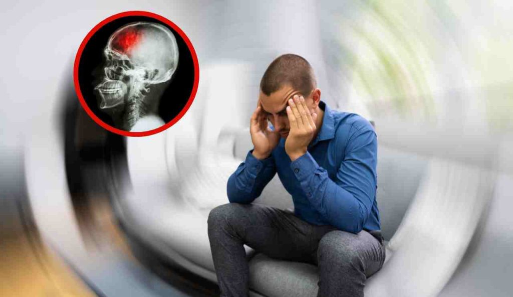 Mal di testa e ictus, occhio ai segnali del tuo corpo | La correlazione allarmante: i sintomi da non sottovalutare